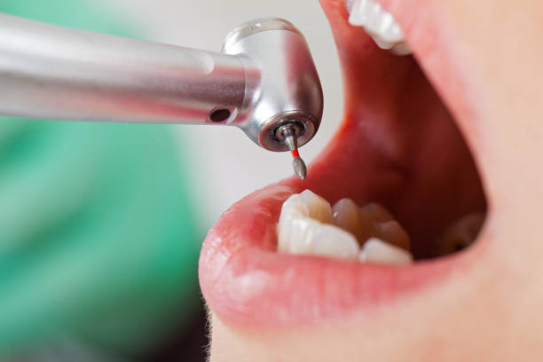 Best Emergency Dental Care for Abscessed Tooth in Woodfield, SC
